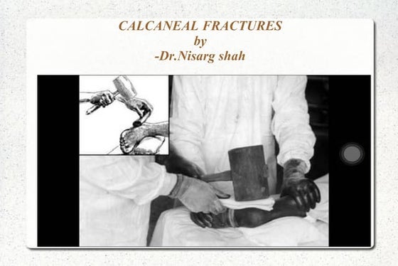 Calcaneu | PPT