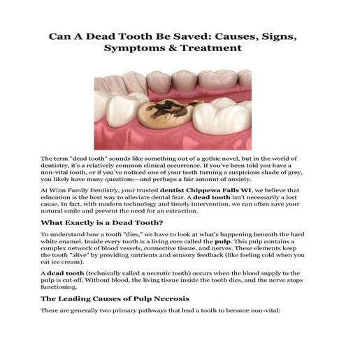 Can A Dead Tooth Be Saved Causes, Signs, Symptoms & Treatment | PDF