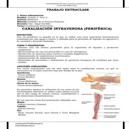 Canalizacion intravenosa [PERIFÉRICA]