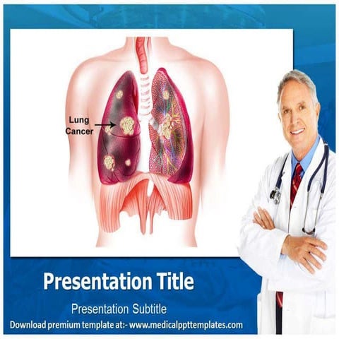 lung-cancer-powerpoint-template-ppt