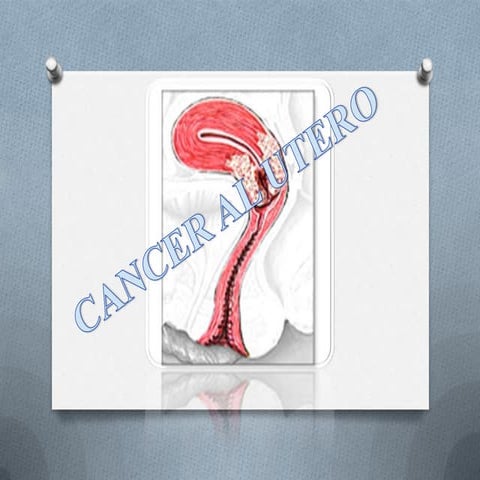 Cancer al utero