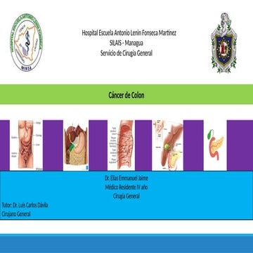 Cancer de Colon en el paciente captado en la consulta de Cirugía ...