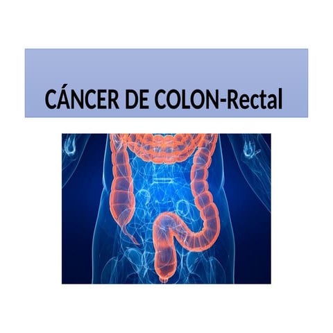 CÁNCER DE RECTO | PPTX