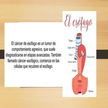 Cancer-de-esofago-concepto-fisiologia-y-anatomia.pptx