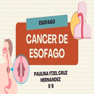 Cancer de esófago - Anatomia , clinica , tratamiento del cancer de ...