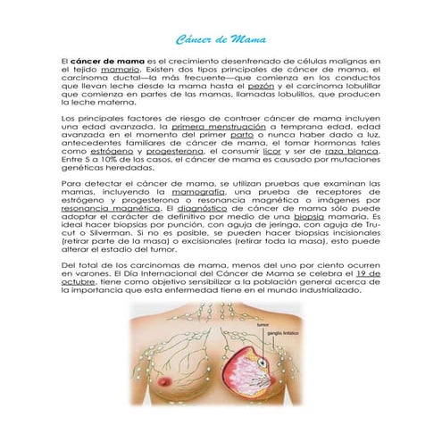 Cancer de mama