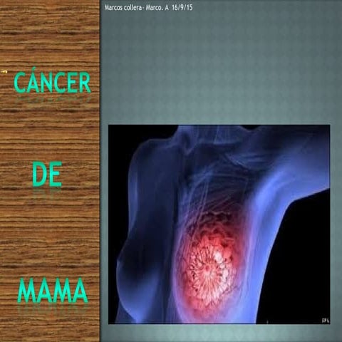 El cáncer de mama