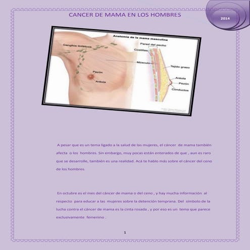 10. Cáncer mama en el varón. Tema de valoracion pptx | PPTX