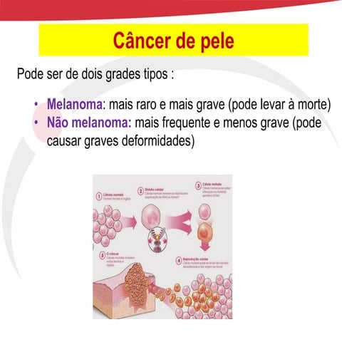 Câncer de pele Melanoma e não melonoma .pdf