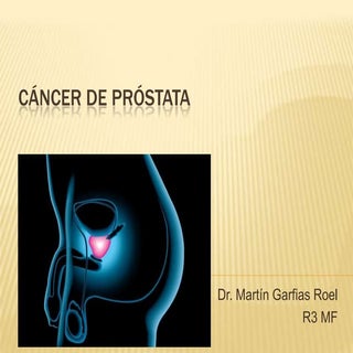 Cancer de prostata