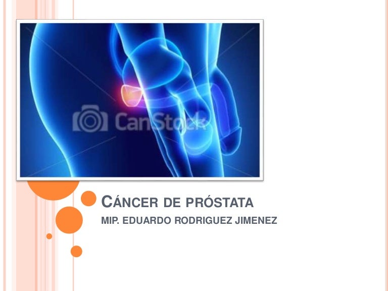 ¿Qué es ICD 10 para el antígeno prostático específico?