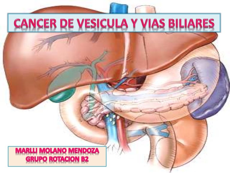 cancer tracto biliar
