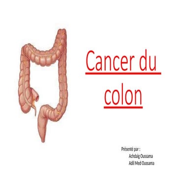 Le cancer du côlon : prévention et soins | PPTX