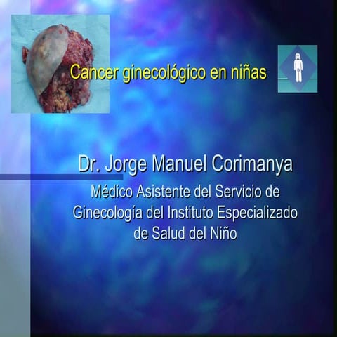 Cancer ginecológico en niñas