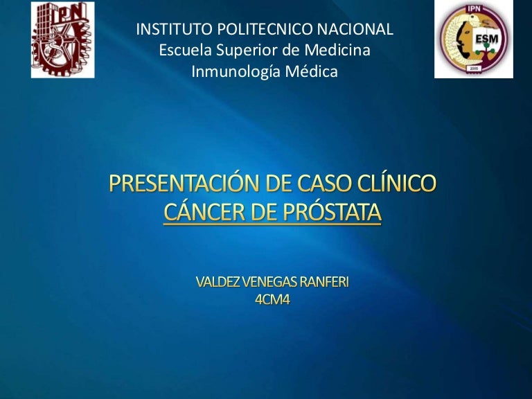 carcinógenos para el cáncer de próstata