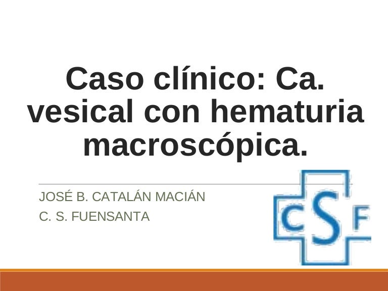 evolución del cáncer de próstata fase final 4