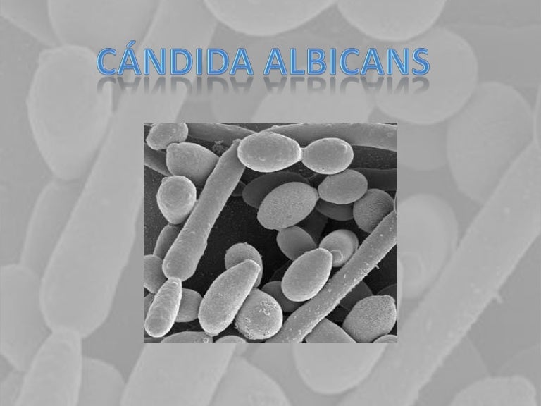 Кандида альбиканс у мужчин фото. Диета при молочнице у женщин. Что ест кандида. Диета при молочнице. Кандида хофер фотографии.