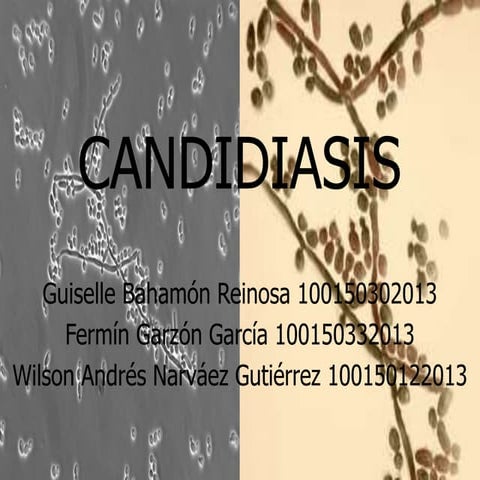 Candidiasis