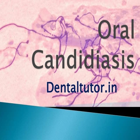 Candidiasis