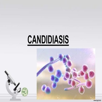 Candidiasis 