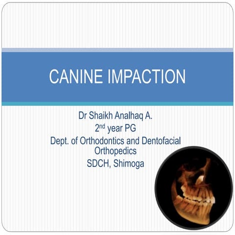 Canine Impaction and Its Importance in Orthodontics