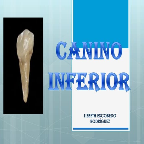 Anatomía dental de los molares superiores | PPTX
