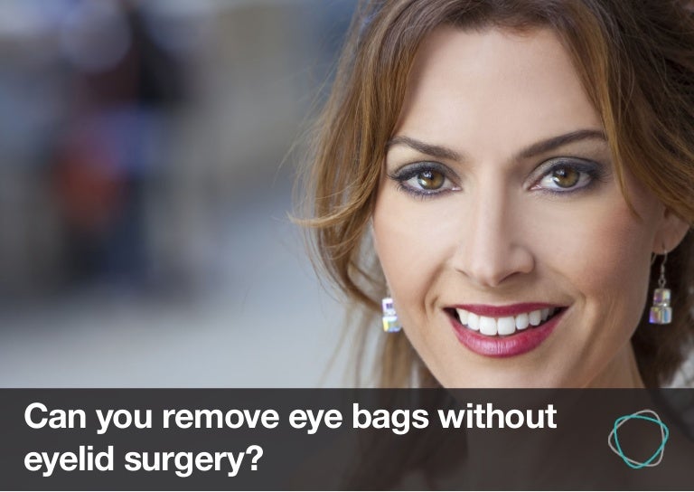 Can You Remove Eye Bags Without Eyelid Surgery?