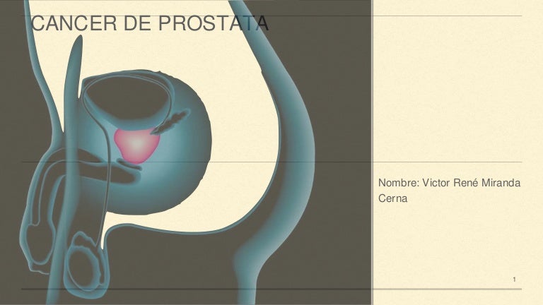 cualquier beneficio para la orciectomía bilateral para el cáncer de próstata