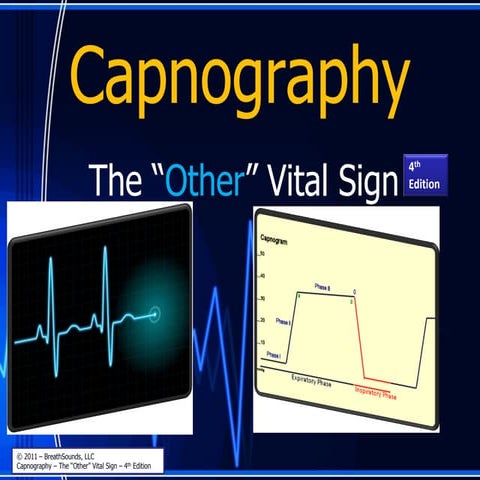 Capnography   the other vital sign