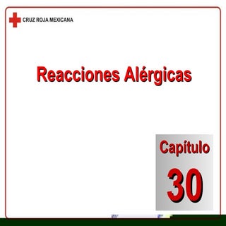 Capítulo 30 Reacciones Alérgicas