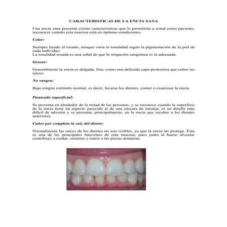 Caracteristicas de la encia sana | PDF
