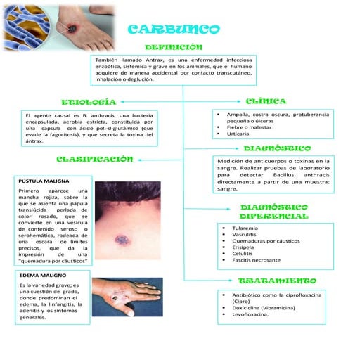 Carbunco: tipos y tratamiento | PPTX