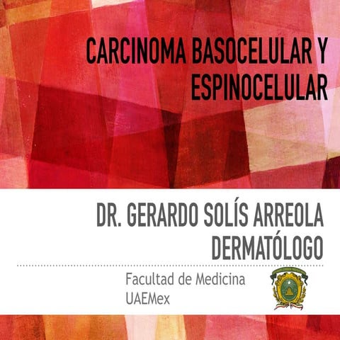 carcinoma-basocelular-y-espinocelular-pdf