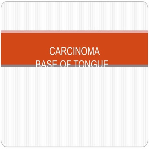 Tongue cancer | PPTX