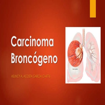 Carcinoma Broncógeno