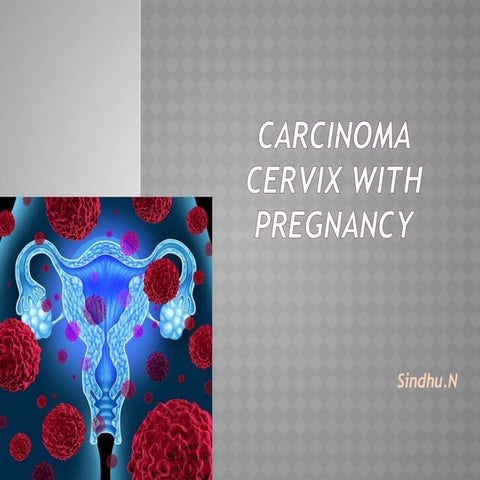 Carcinoma cervix with pregnancy, powerpoint