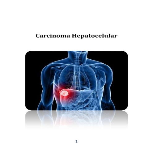 Carcinoma hepatocelular