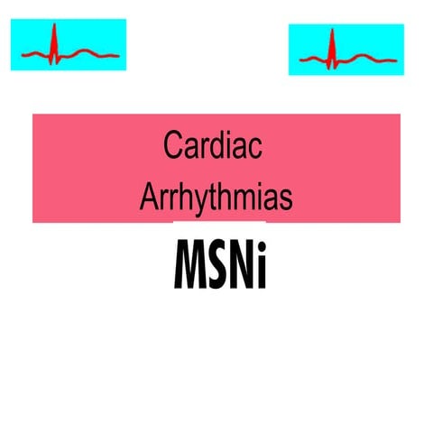 Cardiac arrhythmias