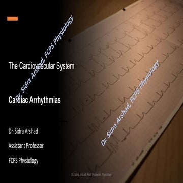Interpretation of ECG - Cardiac Arrhythmias