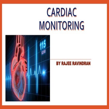 Cardiac monitoring