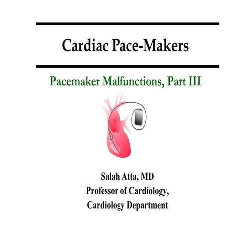 Cardiac pacemakerspart iii