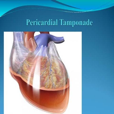 Cardiac Tamponade. presentation in detail