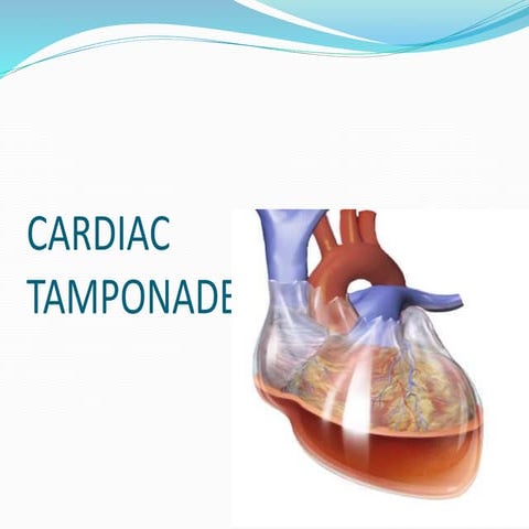 cardiac tamppnade.pptx