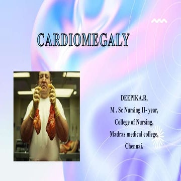 cardiomegaly.pptx, DEEPIKA.R, M. Sc nursing.