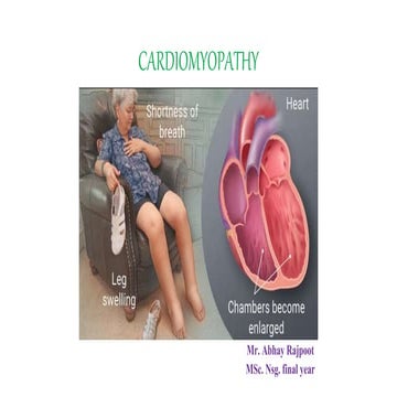 Cardiomyopathy