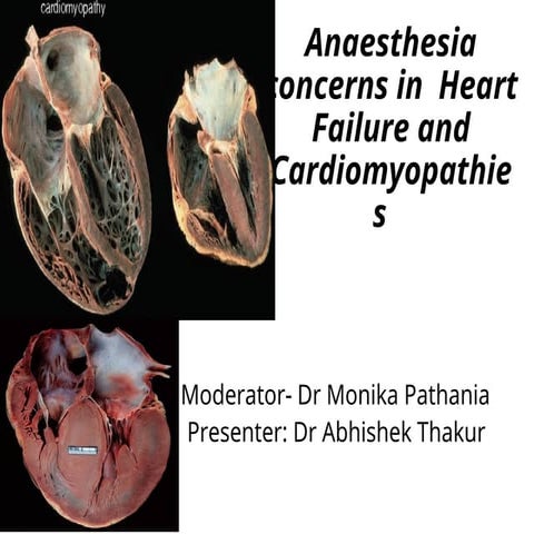 Cardiomyopathy and heart failure concerns