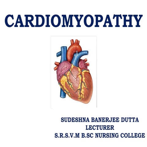 Cardiomyopathy 