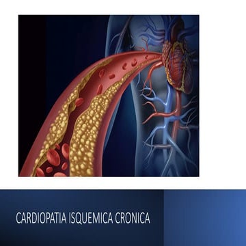 Cardiopatia Isquemica Cronica en pacientes adultos.pptx