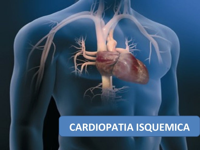 A Fisiopatologia Da Cardiopatia Isquêmica Envolve Especificamente Dois Processos
