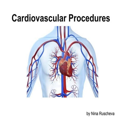 Cardiovascular diagnostic procedures